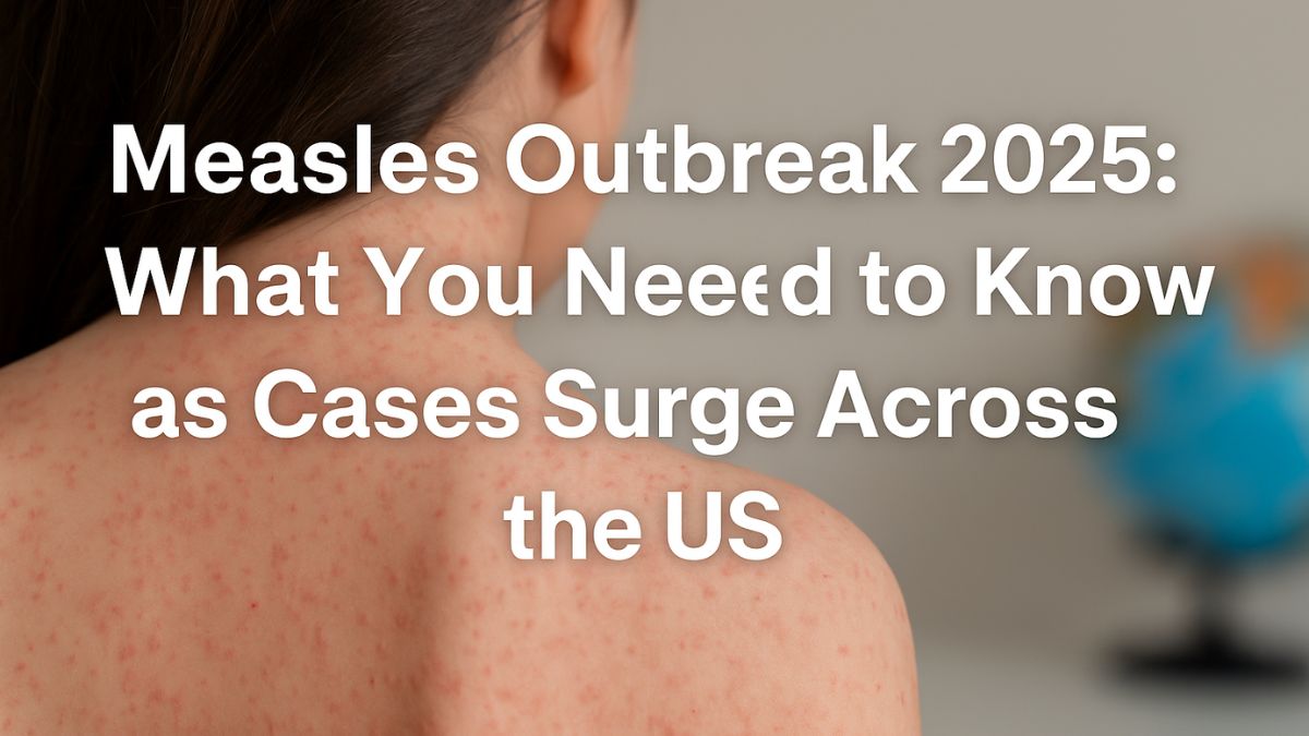 Measles Outbreak 2025: What You Need to Know as Cases Surge Across the US