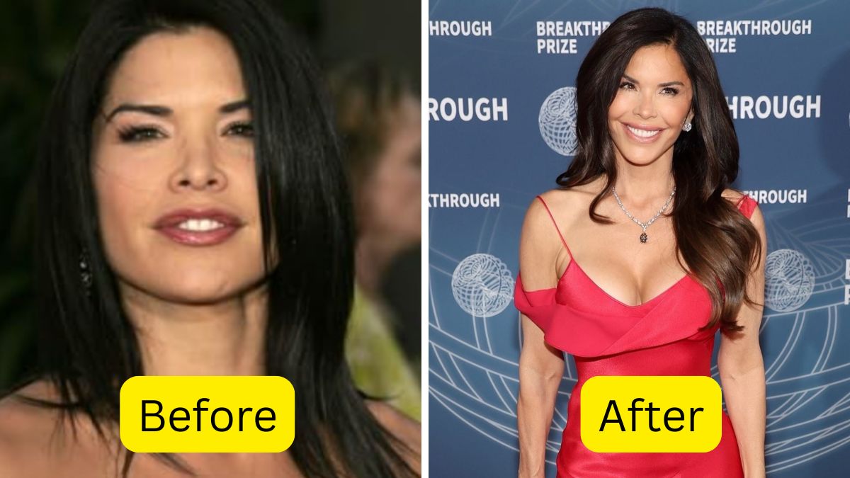 lauren sanchez before and after plastic surgery