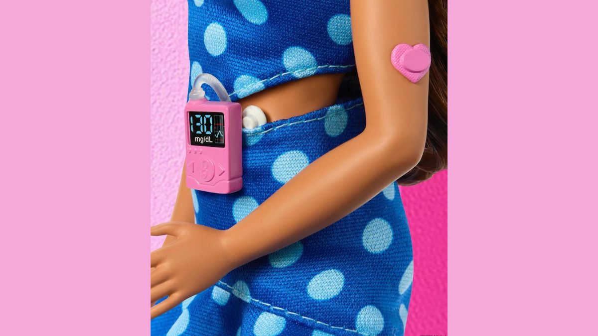Close-up of Barbie doll with Type 1 Diabetes wearing a CGM and insulin pump